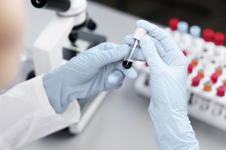 Lekarz hematolog czym zajmuje się hematologia i jakie choroby leczy